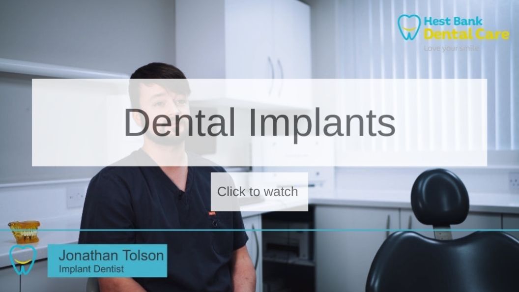 Dental implants process