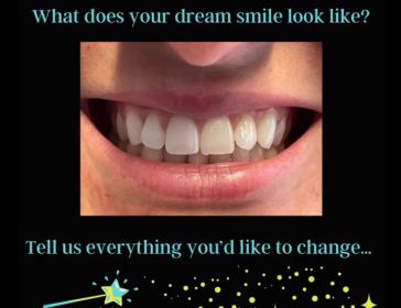 Smilefast