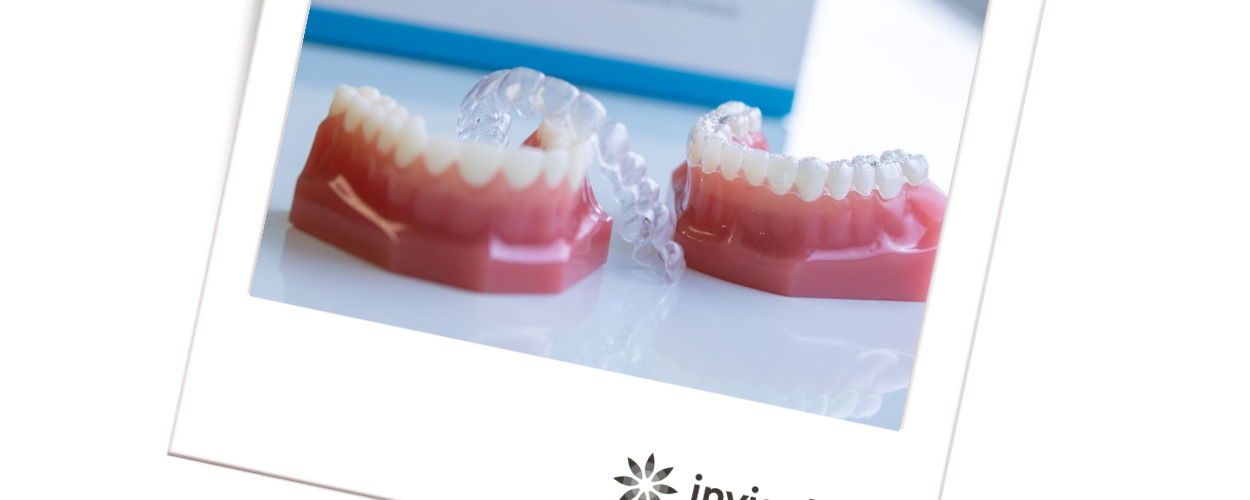 Invisalign Orthodontic treatment