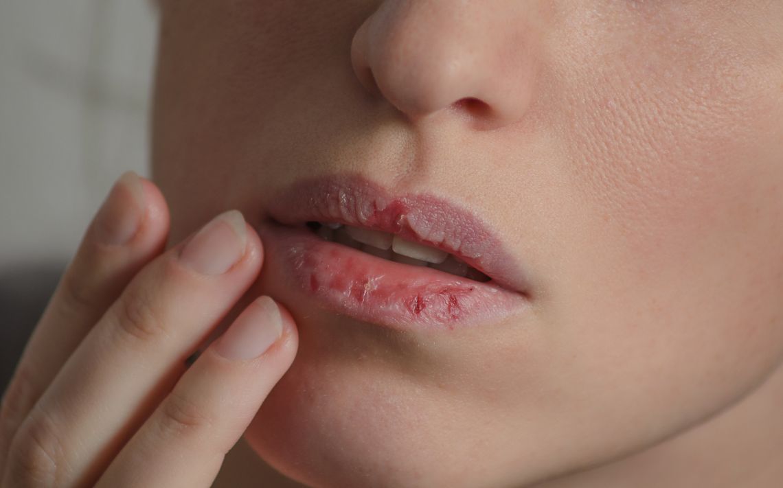 Don't forget your lips