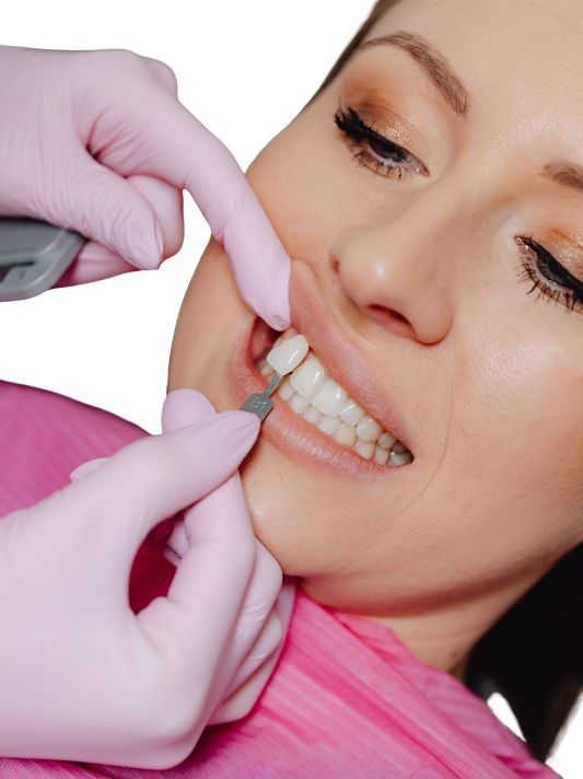 veneers